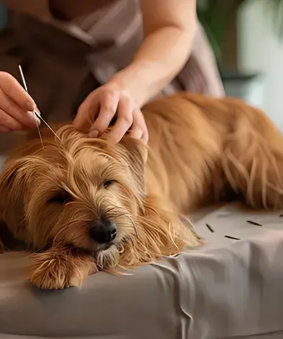 Acupuncture